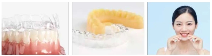 Regain_a_brighter_smile.png Regain_a_brighter_smile.png